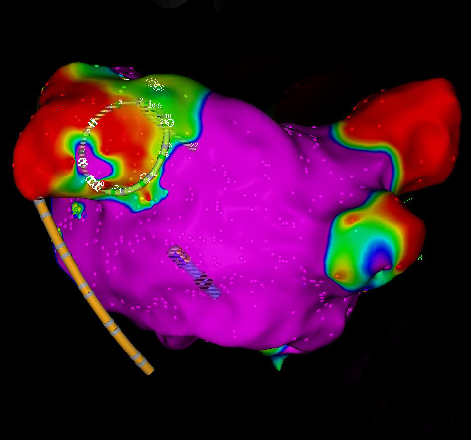 Elektrophysiologie St Antonius Hospital Eschweiler